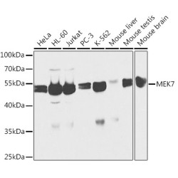 [KO Validated] MEK7 Rabbit pAb