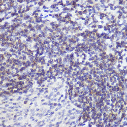 [KD Validated] Bcl-2 Rabbit mAb