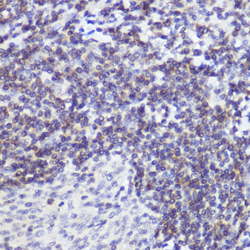 [KD Validated] Bcl-2 Rabbit mAb