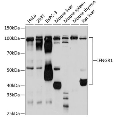 IFNGR1 Rabbit mAb
