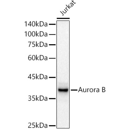 [KD Validated] Aurora B Rabbit mAb