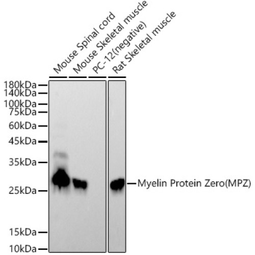 Myelin Protein Zero (MPZ) Rabbit mAb