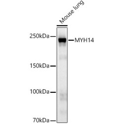 MYH14 Rabbit mAb
