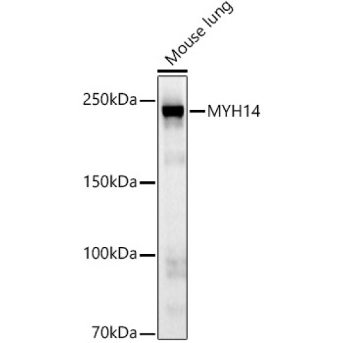 MYH14 Rabbit mAb