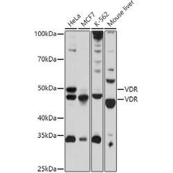 VDR Rabbit pAb