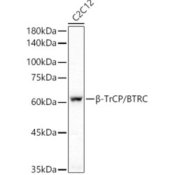 β-TrCP/BTRC Rabbit mAb