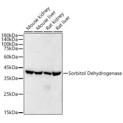 Sorbitol Dehydrogenase Rabbit mAb