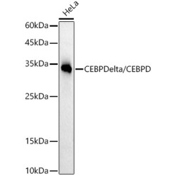 CEBP Delta/CEBPD Rabbit mAb