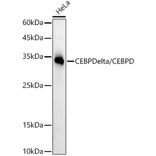 CEBP Delta/CEBPD Rabbit mAb