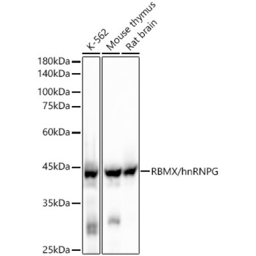 RBMX/hnRNP G Rabbit mAb
