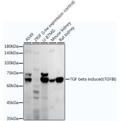 TGF beta induced (TGFBI) Rabbit mAb