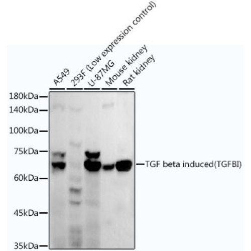 TGF beta induced (TGFBI) Rabbit mAb