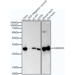 Calretinin Rabbit mAb