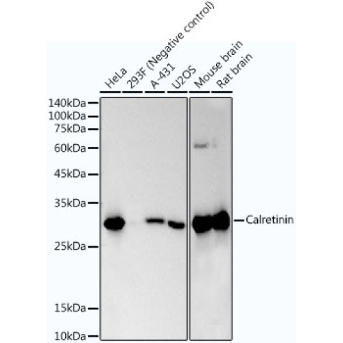 Calretinin Rabbit mAb