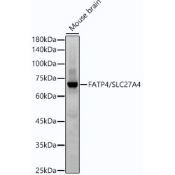 FATP4/SLC27A4 Rabbit mAb