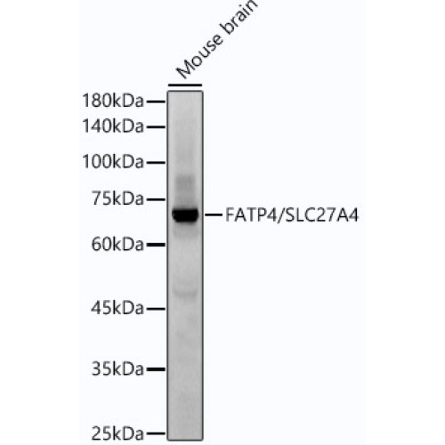FATP4/SLC27A4 Rabbit mAb