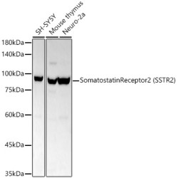 Somatostatin Receptor 2 (SSTR2) Rabbit mAb