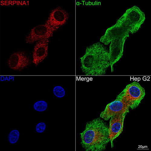 Alpha-1 Antitrypsin (SERPINA1) Rabbit mAb