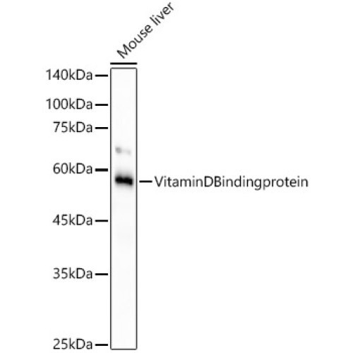 Vitamin D Binding protein Rabbit mAb