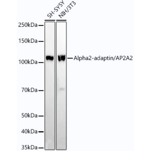 Alpha2-adaptin/AP2A2 Rabbit mAb