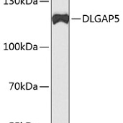 DLGAP5 Rabbit pAb