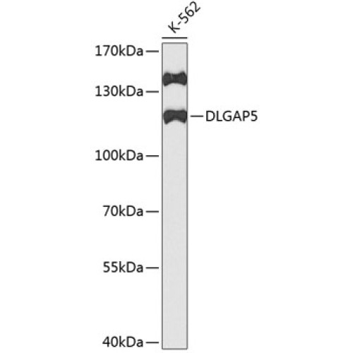 DLGAP5 Rabbit pAb