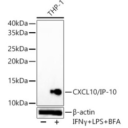 CXCL10/IP-10 Rabbit mAb