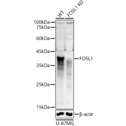 [KD Validated] FOSL1 Rabbit pAb