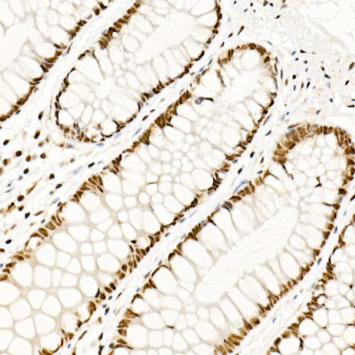 HSF1 Rabbit pAb