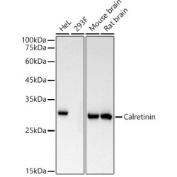 Calretinin Rabbit mAb