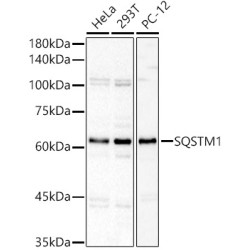 SQSTM1 Rabbit pAb