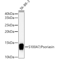S100A7/Psoriasin Rabbit pAb