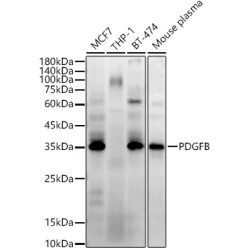 PDGFB Rabbit mAb