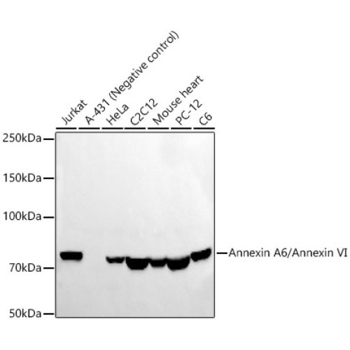 Annexin A6/Annexin VI Rabbit mAb