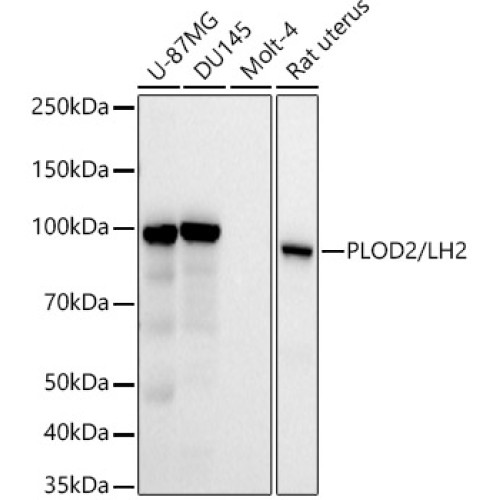 PLOD2/LH2 Rabbit mAb