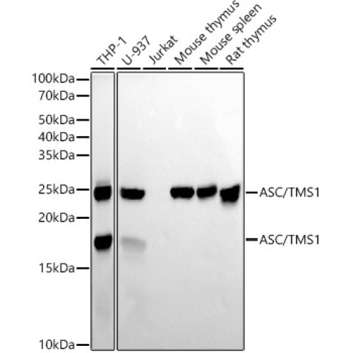 ASC/TMS1 Rabbit mAb