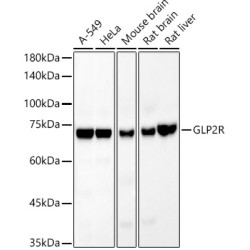 GLP2R Rabbit mAb