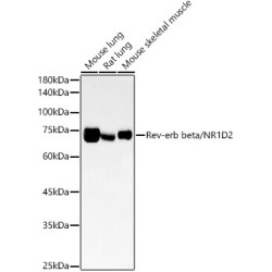 Rev-erb beta/NR1D2 Rabbit mAb
