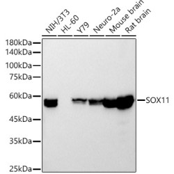SOX11 Rabbit mAb