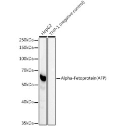 Alpha-Fetoprotein (AFP) Rabbit mAb
