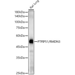 PTPIP51/RMDN3 Rabbit mAb