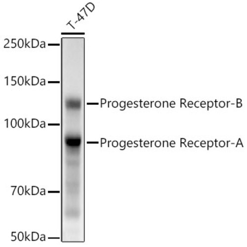 Progesterone Receptor Rabbit mAb