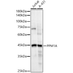 PPM1A Rabbit mAb