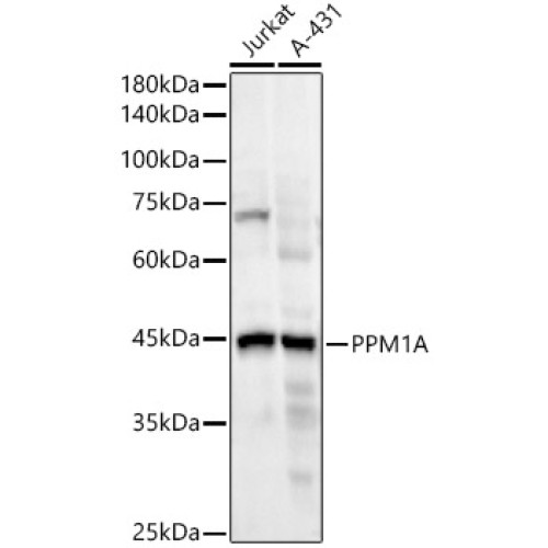 PPM1A Rabbit mAb