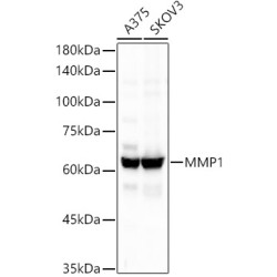 MMP1 Rabbit mAb