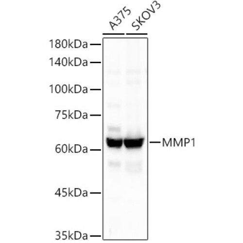 MMP1 Rabbit mAb