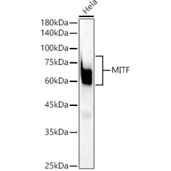 MITF Rabbit mAb