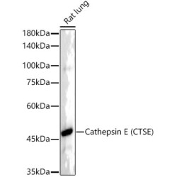 Cathepsin E (CTSE) Rabbit mAb