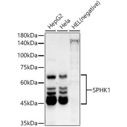 SPHK1 Rabbit mAb