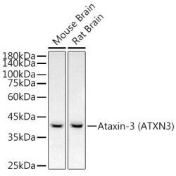 Ataxin-3 (ATXN3) Rabbit mAb